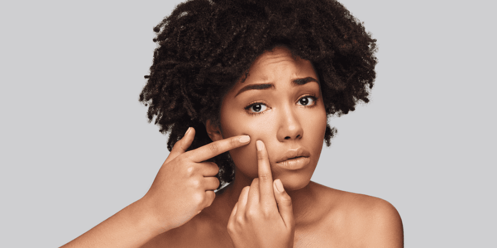 black woman putting cbd oil on her acne