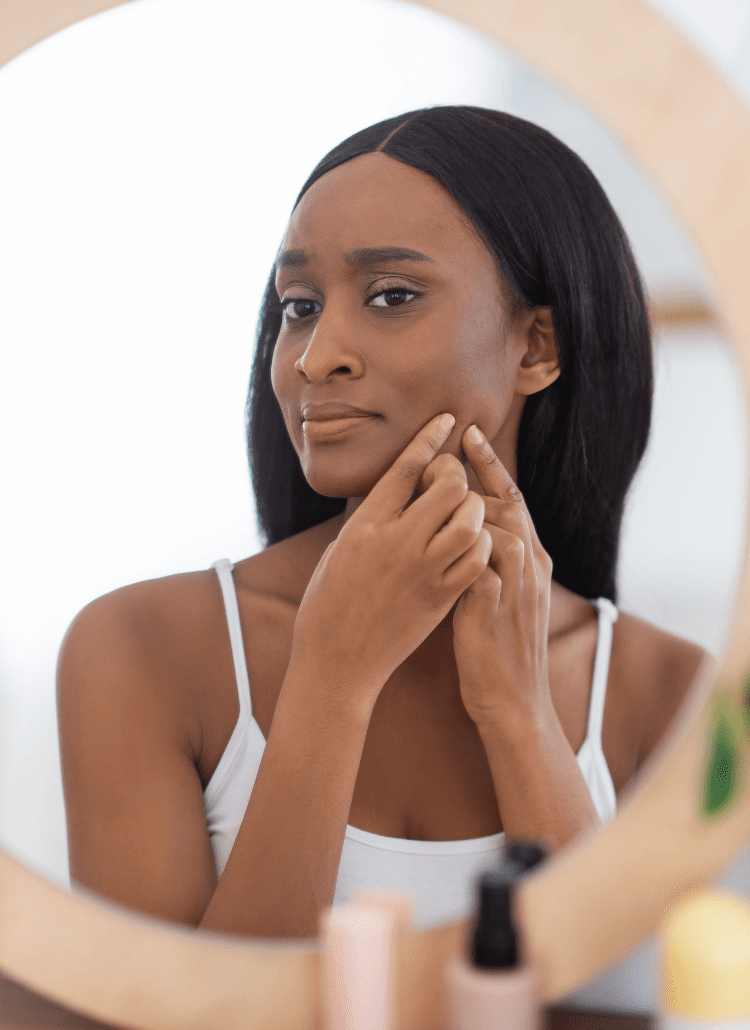 young black woman applying cbd skincare for acne