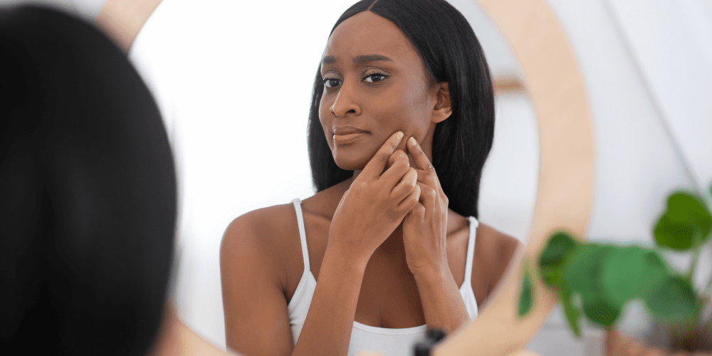 young black woman looking at acne or zits on her skin in the mirror