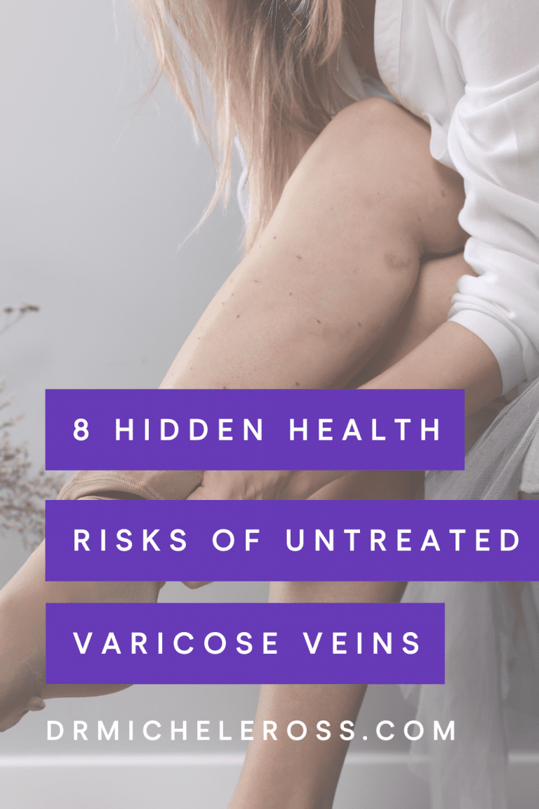 8 Hidden Health Risks Of Untreated Varicose Veins Dr Ross 