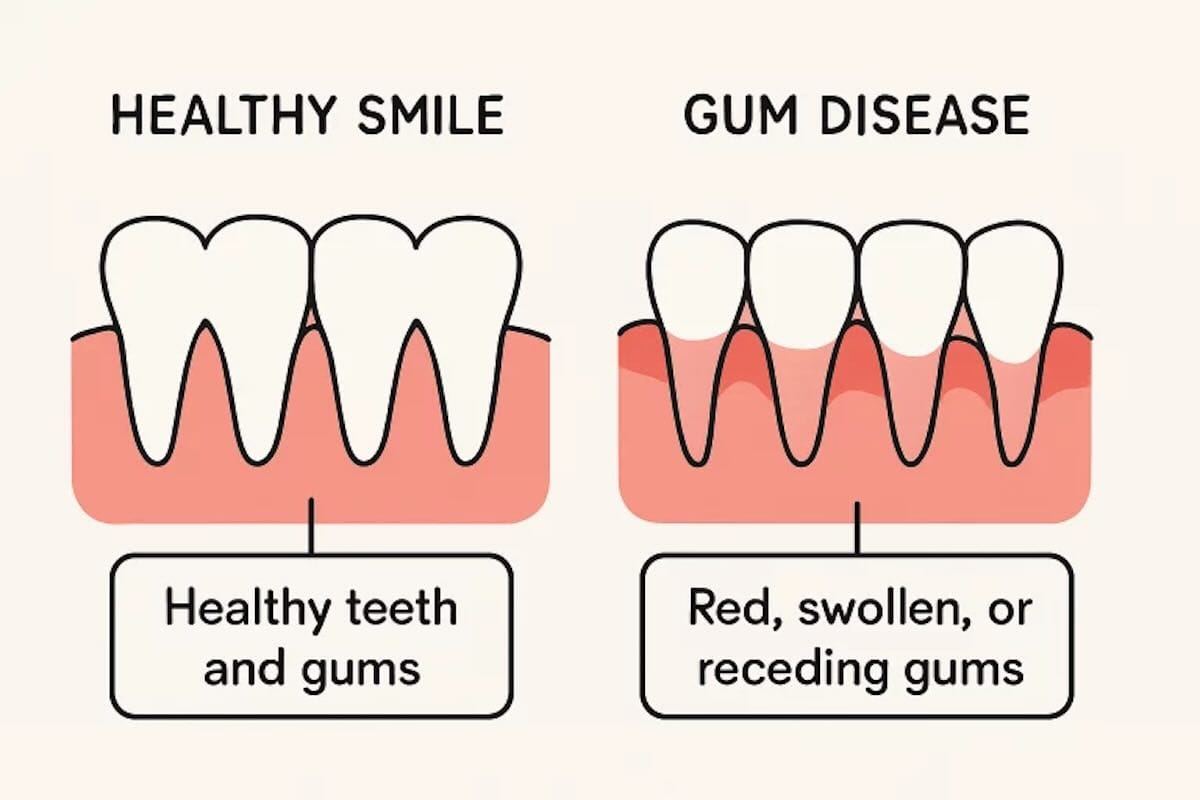healthy teeth and gums versus red, swollen and receding gums