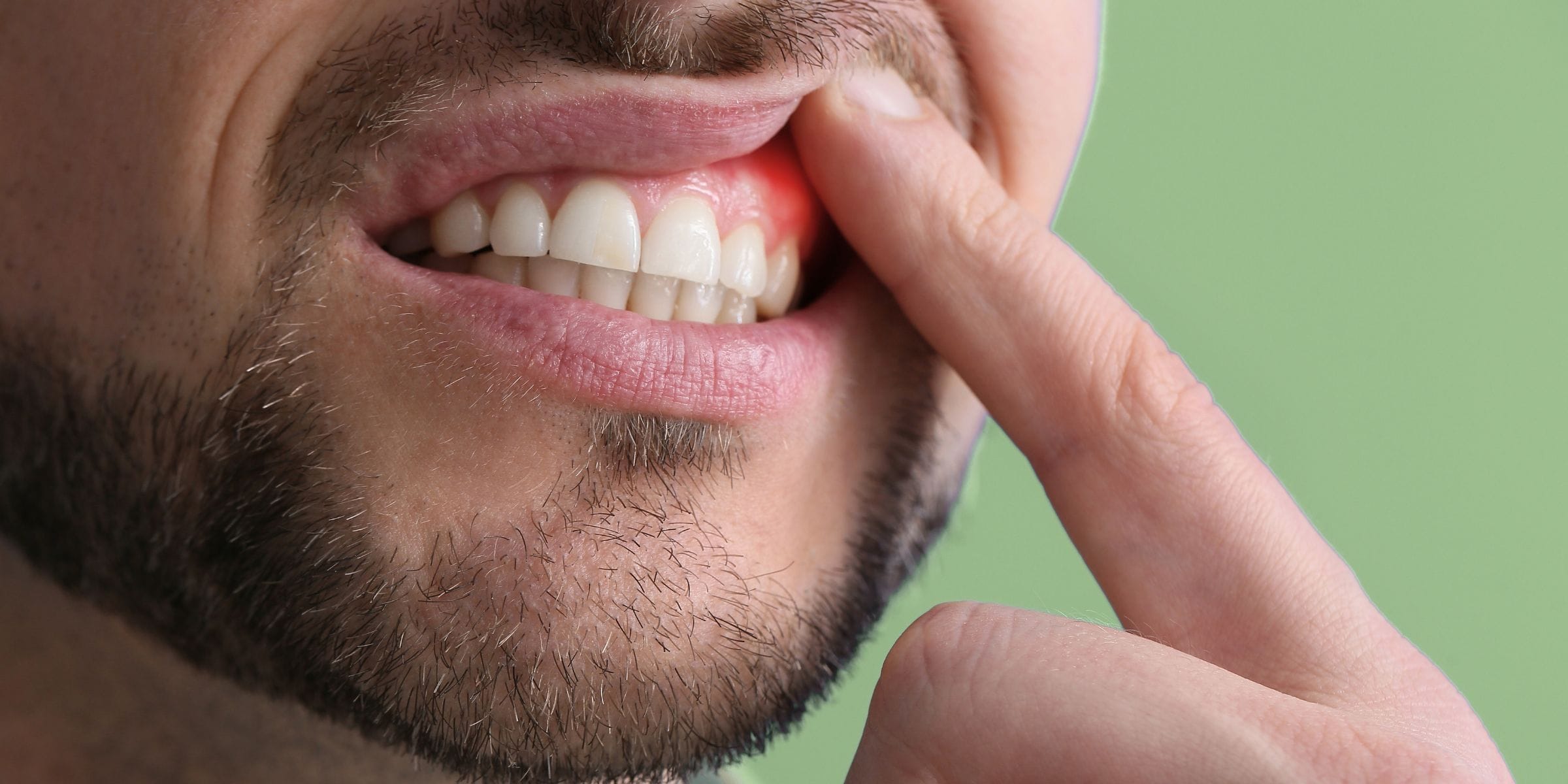 man pressing finger on inflamed gums with gum disease