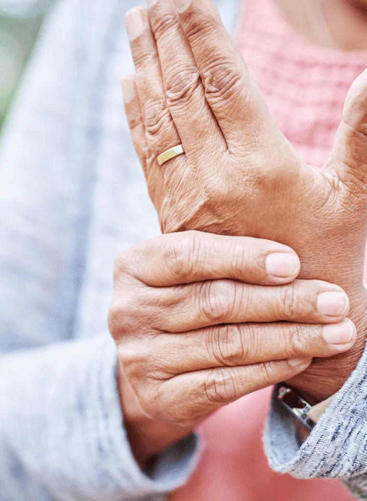 senior woman holding arthritis hand needs steroids for pain