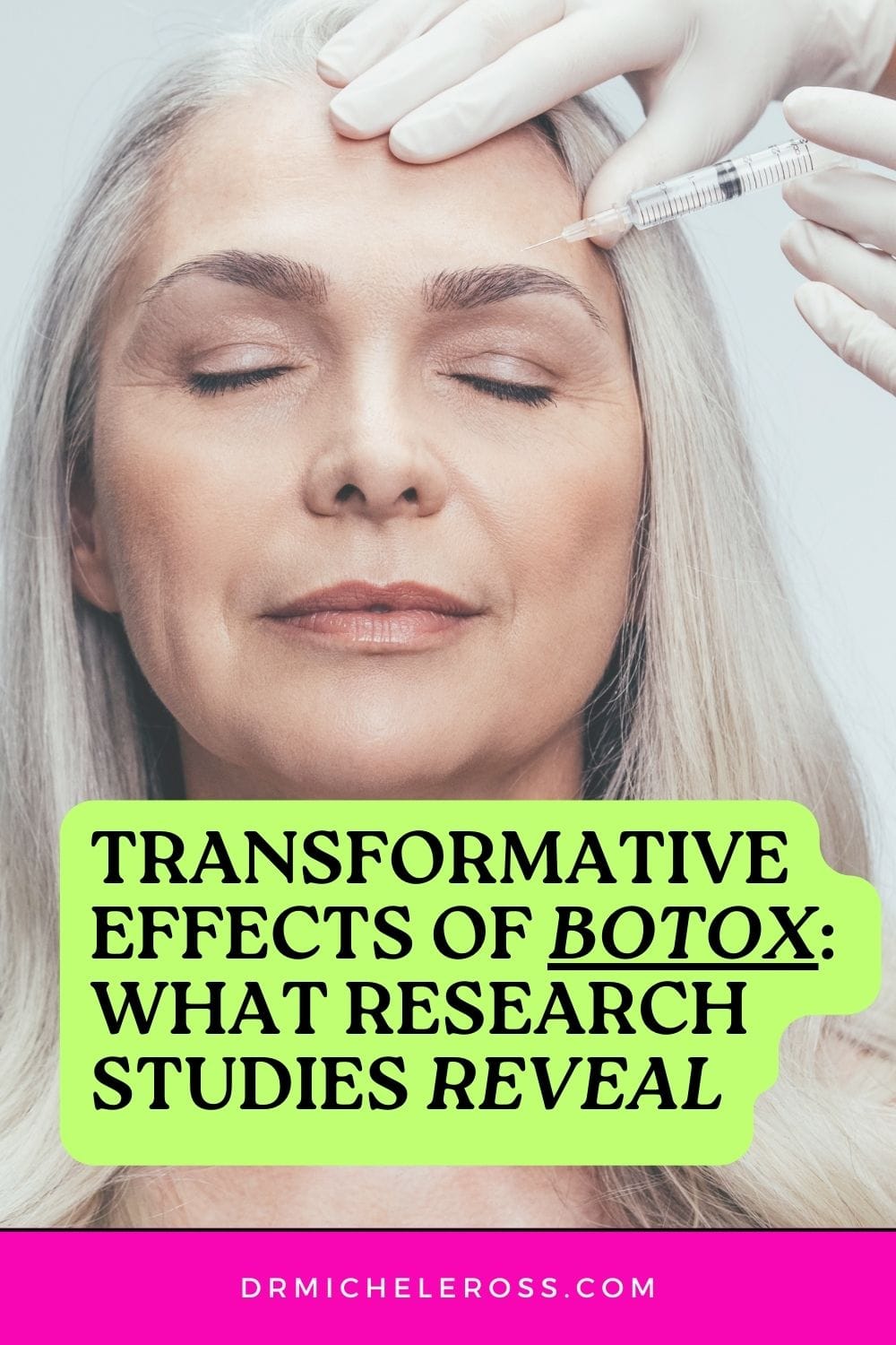 transformative effects of botox treatment: what research studies reveal pinterest pin