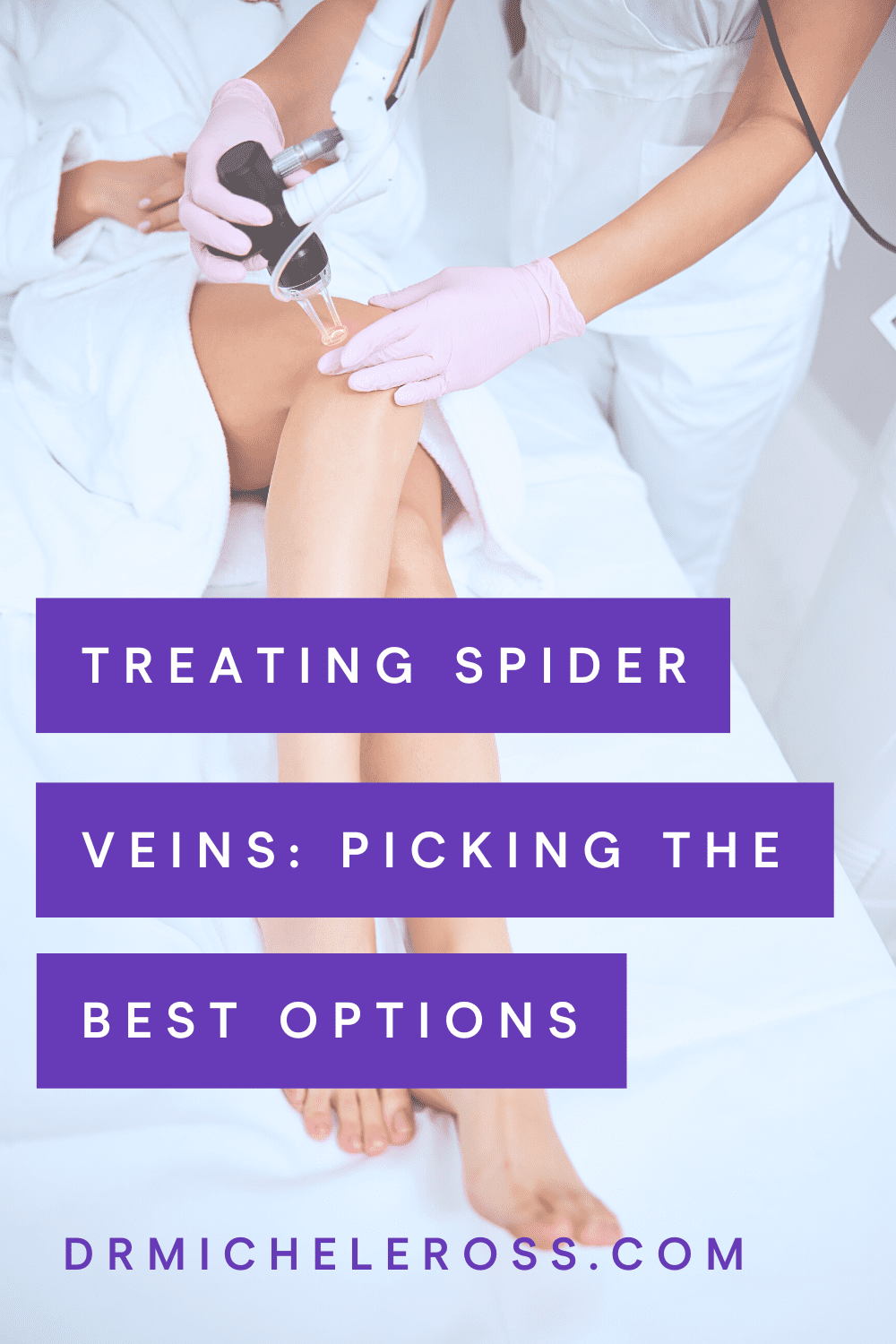 Treating Spider Veins: Picking The Best Options Available