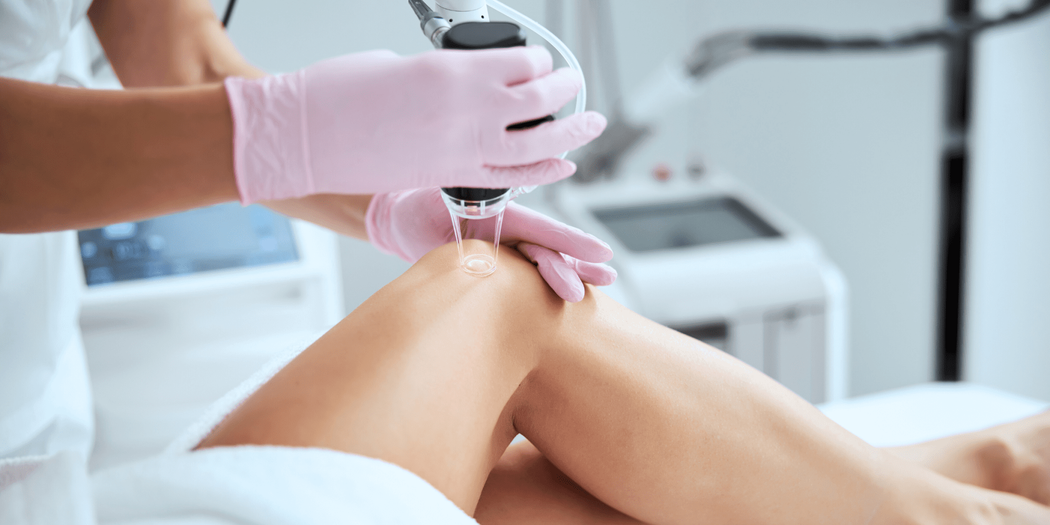 woman receiving Endovenous laser therapy treatment for spider veins