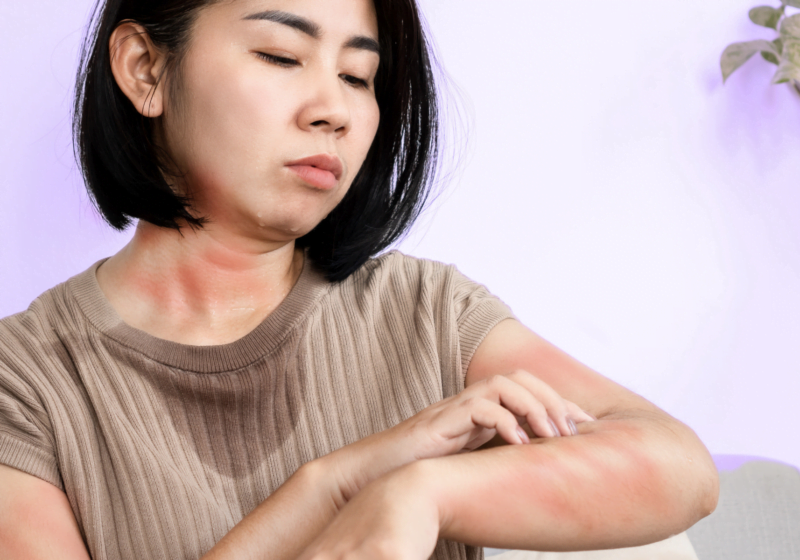 asian woman sweating scratching red rash with unknown health issues purple bedroom