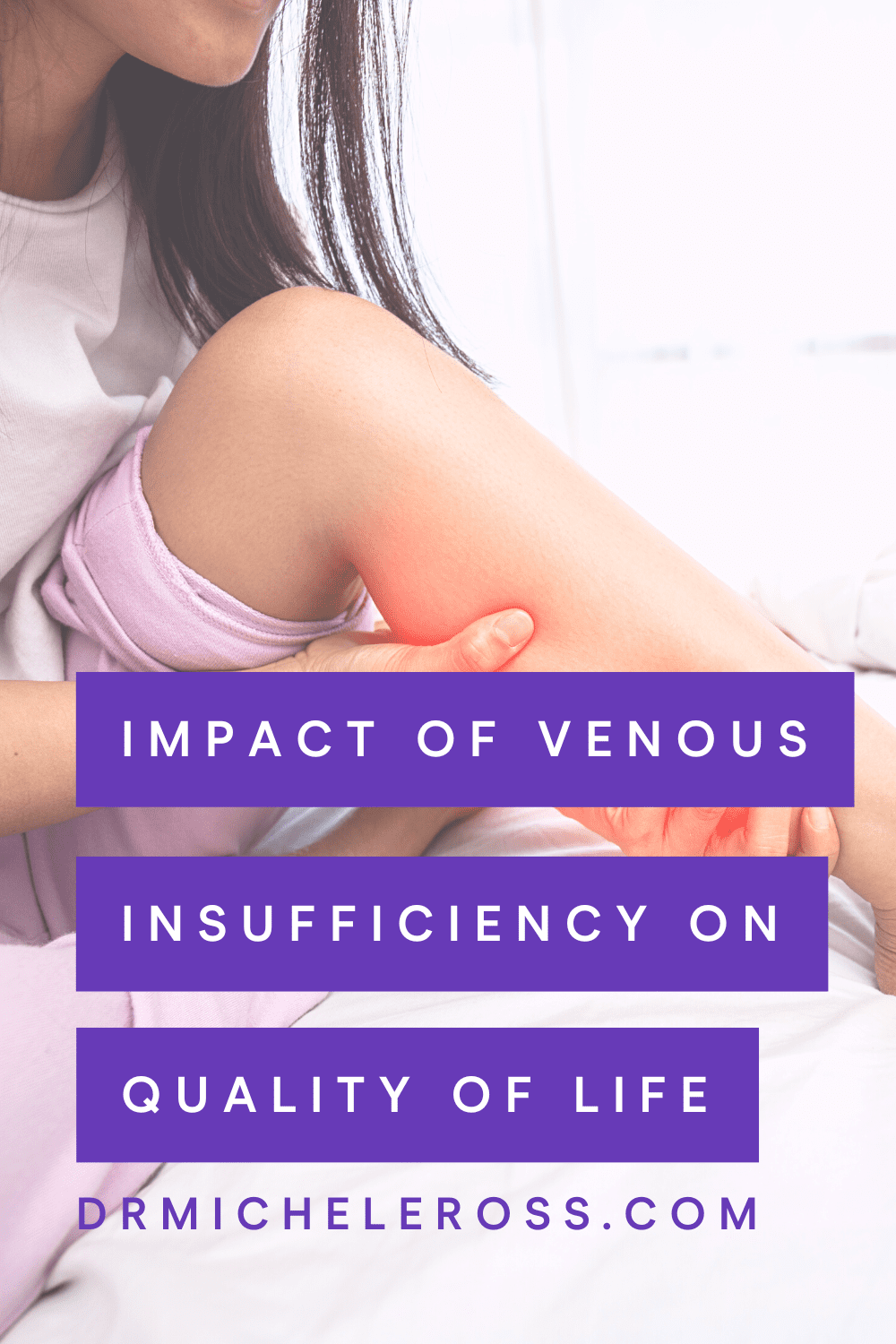 woman with poor quality of life holding painful leg with venous insufficiency