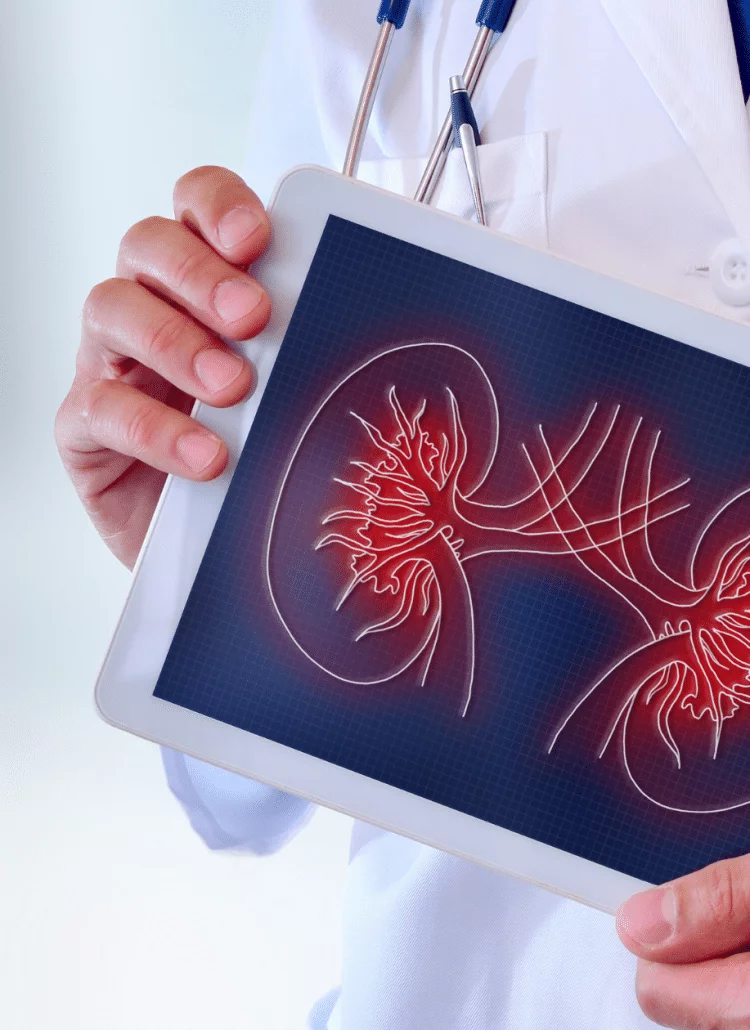male doctor holding picture of kidneys