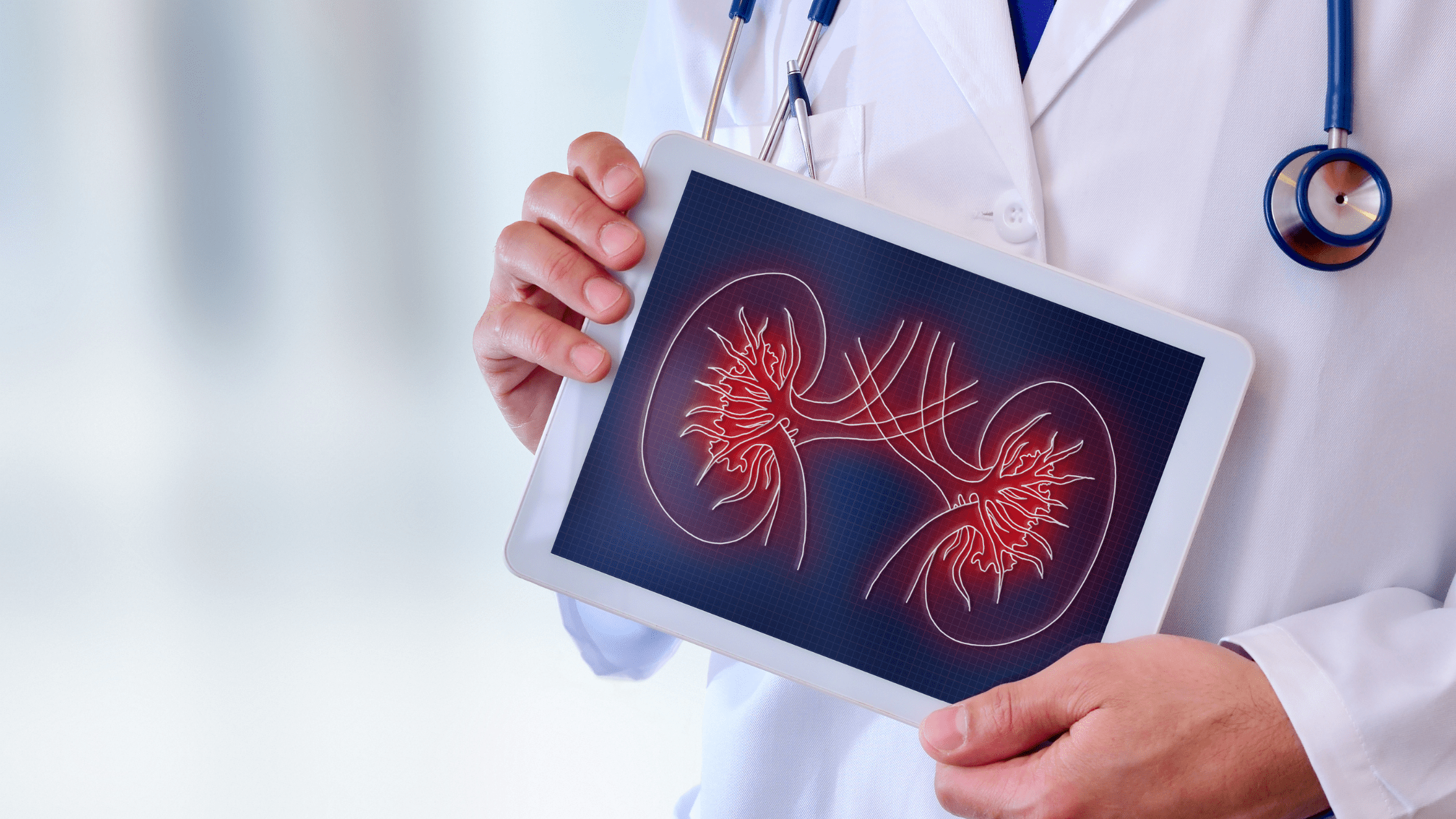 male doctor holding picture of kidneys